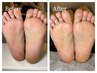 【FOOT】足裏角質ケア¥7,700