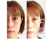 雅 クリニカルルームの雰囲気（フィイスケア・小顔調整。お顔の"健康"を重視した施術で変化を♪）
