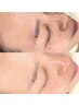 1番綺麗持続！美肌ケアSet【ノーファンデ健康で美しい肌】毛穴/WAX/生パック