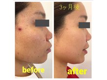 セレブリボーン 大阪ボーテの雰囲気（肌、本来の【美肌維持力】を再生させる。肌荒れも美しく。）