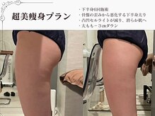 ラブミー 渋谷本店(LoveMe)/骨盤/ハイパーナイフEX/渋谷痩身