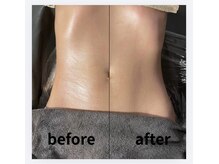 ティースタイル(T-Style)/before/after