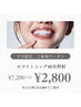 【平日限定ご新規様クーポン】ホワイトニング40分照射¥7,200→¥2,800