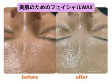キムスビ(Kimusubi)の雰囲気（美肌に特化したフェイシャルWAXで艶スベ肌に。毛穴/ニキビ/草津）