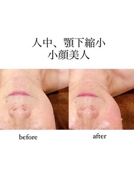 アリュール(Allure)/小顔コルギ（５０代女性）