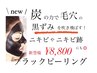 【◆NEW◆毛穴の黒ずみ&ニキビケア】ブラックピーリング　18700円→8800円