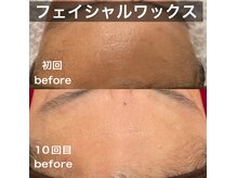 レティ(Letty)の雰囲気（◆フェイシャルワックス）
