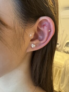サロンアールミヨン(Salon R Miyon)/話題の耳ツボジュエリー