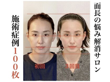 小顔22 ボルティ 本店(Bolty)の写真