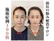 小顔22 ボルティ 本店(Bolty)の写真