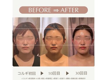 アイミーボーテ(Aime beaute)/コルギ