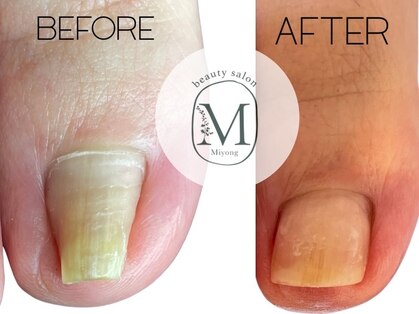 ミヨン 喜多見店(Miyong)の写真