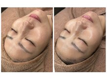 パンパラソル(Pin Parasol)/韓国発！！人気の”ララピール”