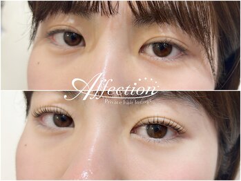 アフェクション アイビューティー(Affection eye beauty)/