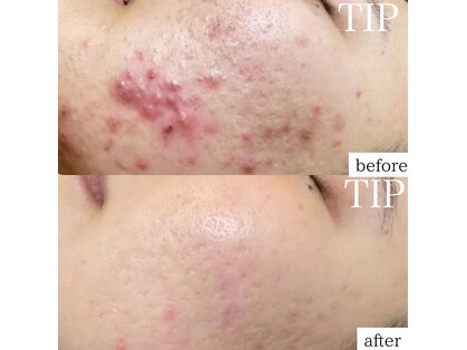 ルポ(RUPO)の写真