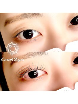 チュラアイズ(CerahEyes)/【お客様ビフォーアフター】