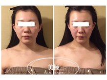 美極 銀座店/銀座/小顔コルギ/小顔矯正