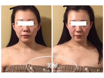 美極 銀座店/銀座/小顔コルギ/小顔矯正