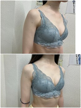 バーディー(BIRDIE)/施術1回/20代