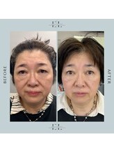 モア(eyelash salon MOOR)/最強フェイシャル