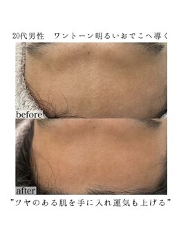 ヴェルシック(Belchic)/男性のくすみにも効果抜群