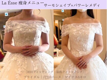 ラエッセ(La Esse)の写真