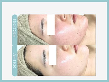 スリムライン 八戸店(The Slim Line)/before→after