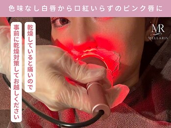 アンテサロン 関内店(Antesalon)/唇の黒ずみメラニンケア施術風景