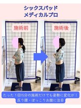 岡町おうち鍼灸整骨院/EMS　ビフォー・アフター