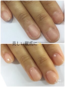 最強のネイルケア