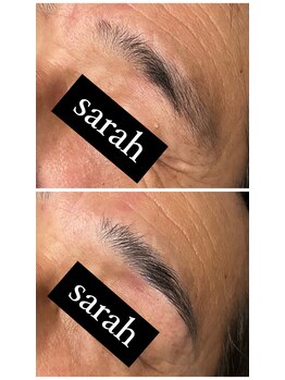 サラ(Sarah)/メンズハリウッドブロウリフト