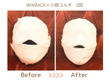 リトリト(Retreat)/小顔コルギビフォアフター 5回