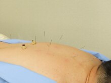 鍼灸ねこの手 高輪