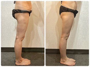 美容整体ウェリナ 中川八田院/小顔矯正/骨盤矯正/美脚サロン