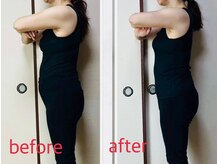 リリィ(RIRY)/【痩身ビフォーアフター】