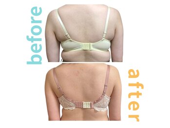 シエル(Ciel)/施術１回→施術４回