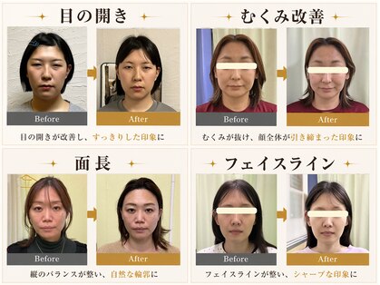 整音(totonone)の写真