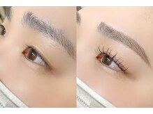 アイビー(eyebee)/アンドヘルシー