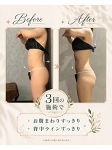 リンガ(Ringa)/3回で変わる美姿勢ライン