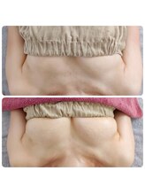 美人バスト リグラス(ReGrous)/バストアップbefore,after