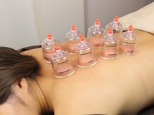 リトリートハリ 青山院(Re:treat HARi)/カッピング