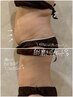 【究極ダイエット】脂肪冷却1cup×脂肪分解マシン（大量おまけ付） 66000円～