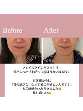 ピオニー(Peony)/Before & After
