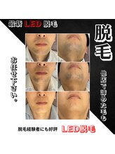 リノミラ(LINOMIRA)/濃い毛に諦めた方にも自信あり☆