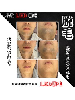 リノミラ(LINOMIRA)/濃い毛に諦めた方にも自信あり☆