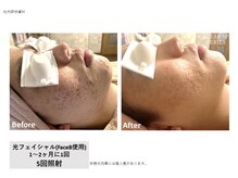 シズク ビューティーサロン(SHIZUKU beauty salon )/
