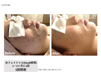 シズク ビューティーサロン(SHIZUKU beauty salon )/