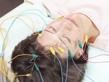 鍼灸チェリーハンド/電気を流す美容鍼