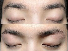 日々粋肌の雰囲気（眉毛や産毛など、レ一ザ一で脱毛しきれない所もお任せください☆）