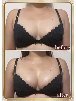 ブルーム(bluem)/離れていたバストが中央に☆